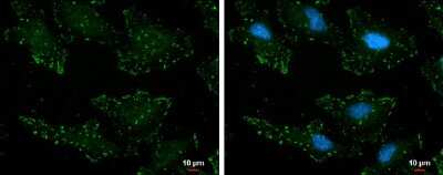 Immunocytochemistry/ Immunofluorescence: p130Cas/BCAR1 [p Tyr165] Antibody [NBP3-13075]